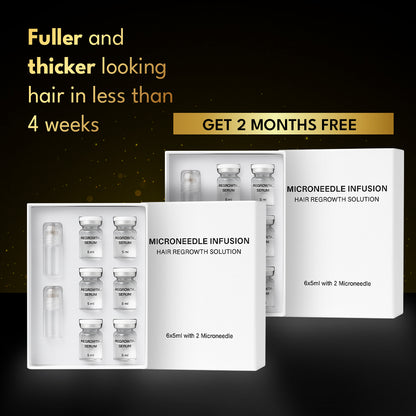 The 5 min/week Hair Regrowth System