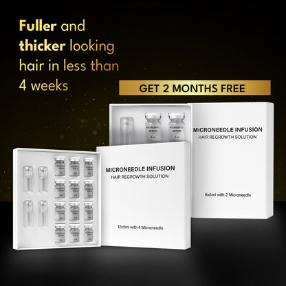 The 5 min/week Hair Regrowth System