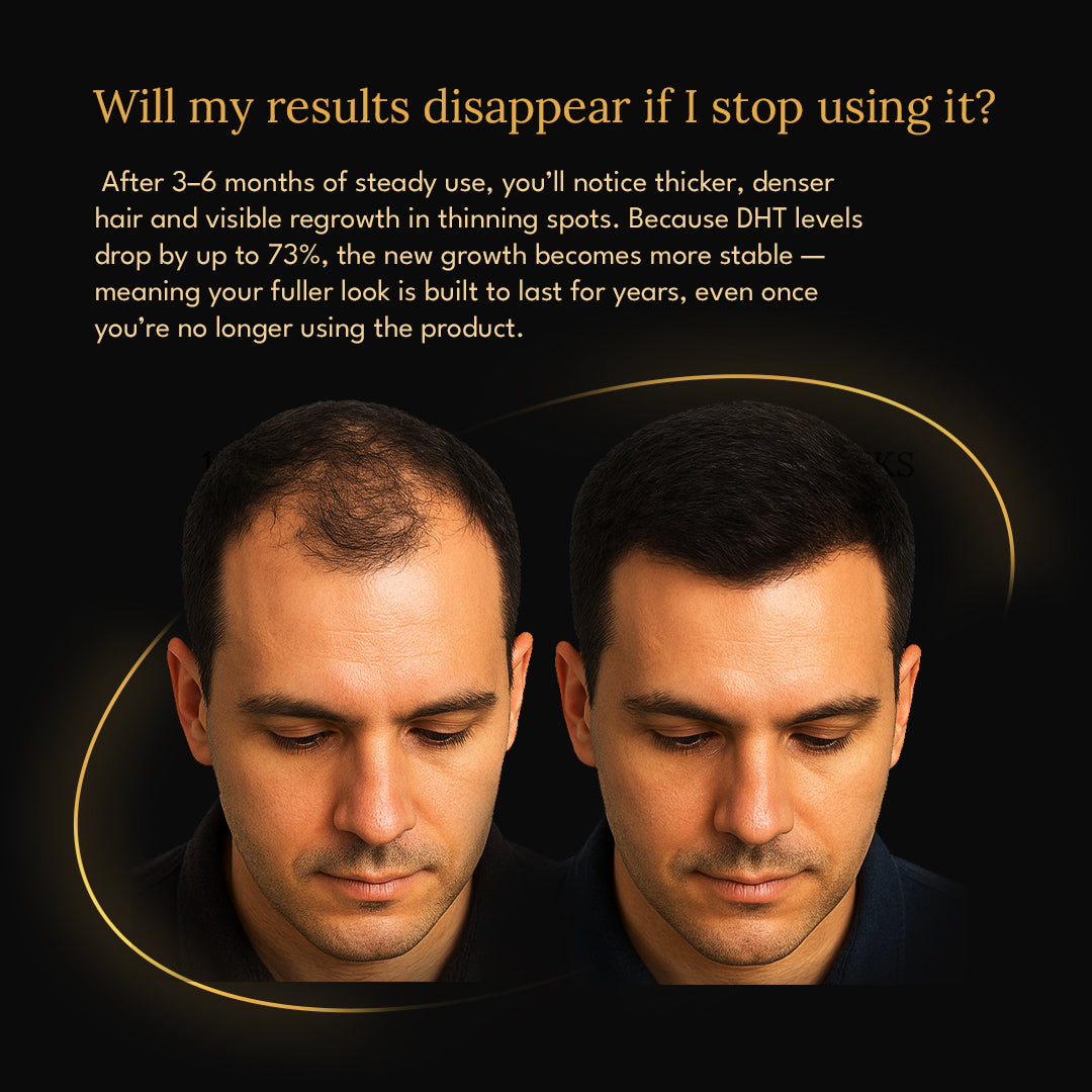 The 5 min/week Hair Regrowth System
