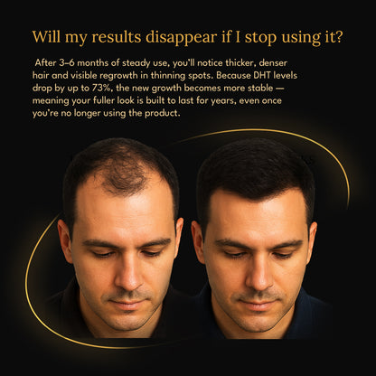The 5 min/week Hair Regrowth System